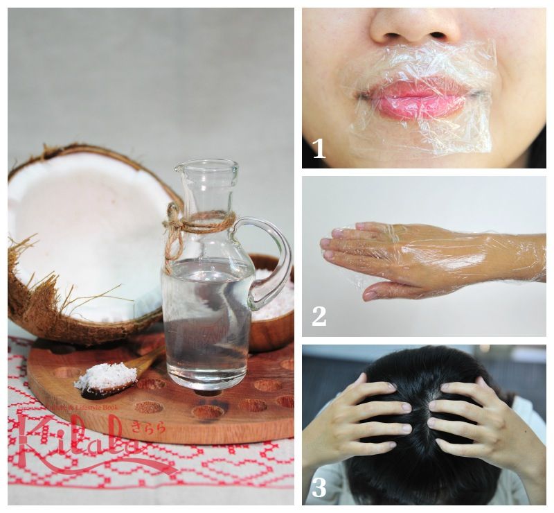 liệu pháp dầu dừa